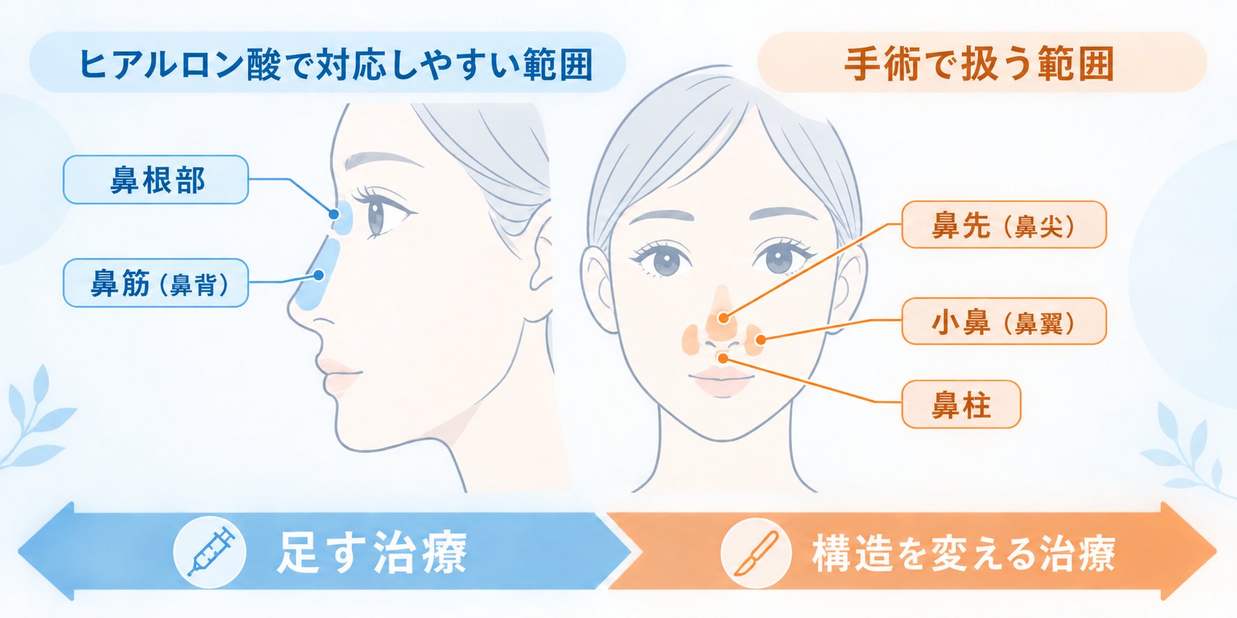 鼻先の丸みや小鼻の広がり、ヒアルロン酸注入で改善可能か解説