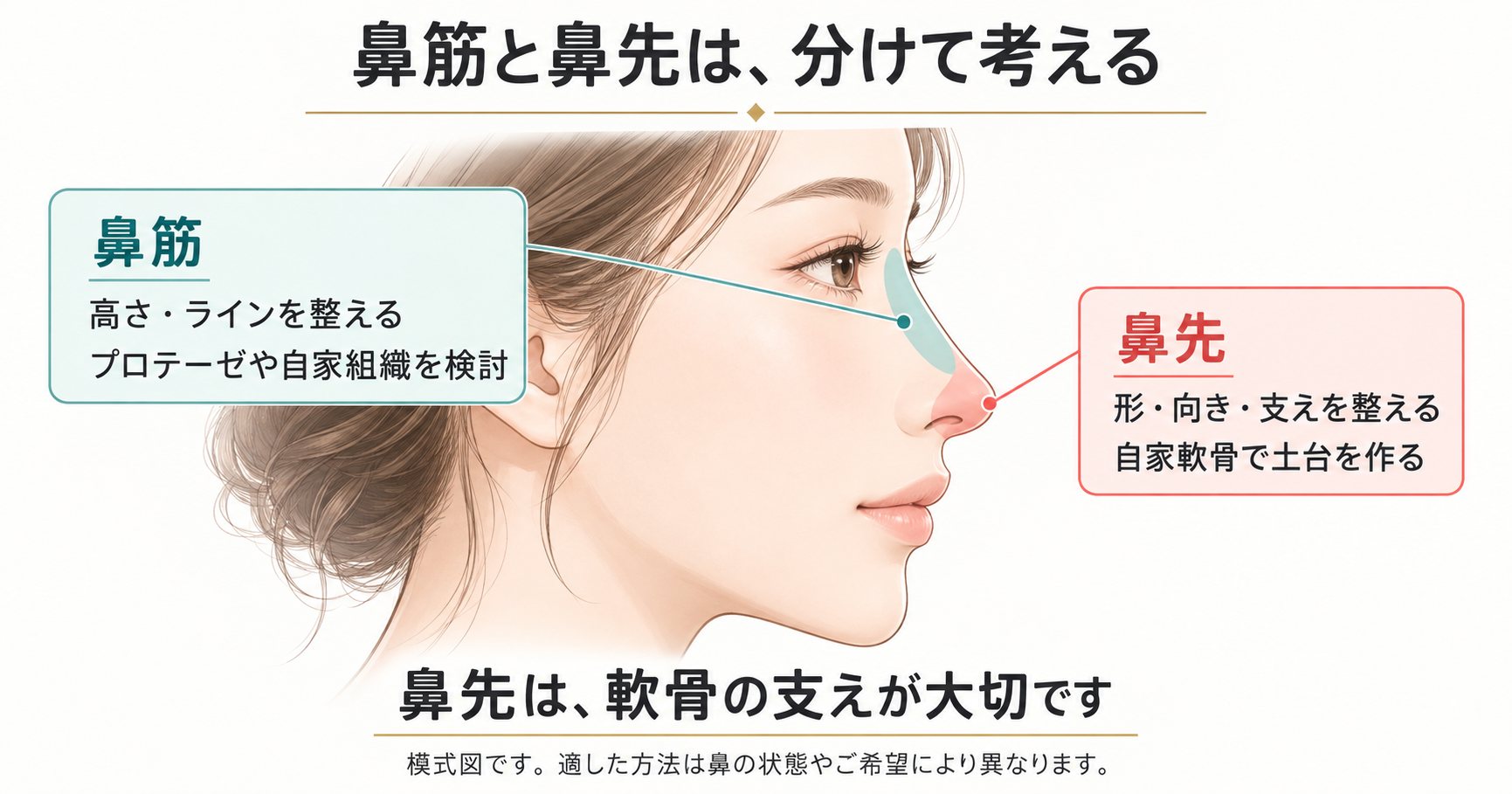 鼻筋と鼻先を分けて考える理由とL型プロテーゼが用いられなくなった経緯