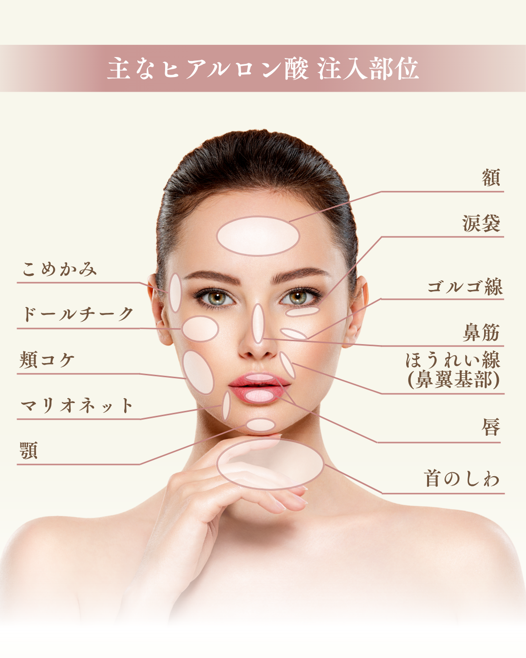 ヒアルロン酸注入適応部位