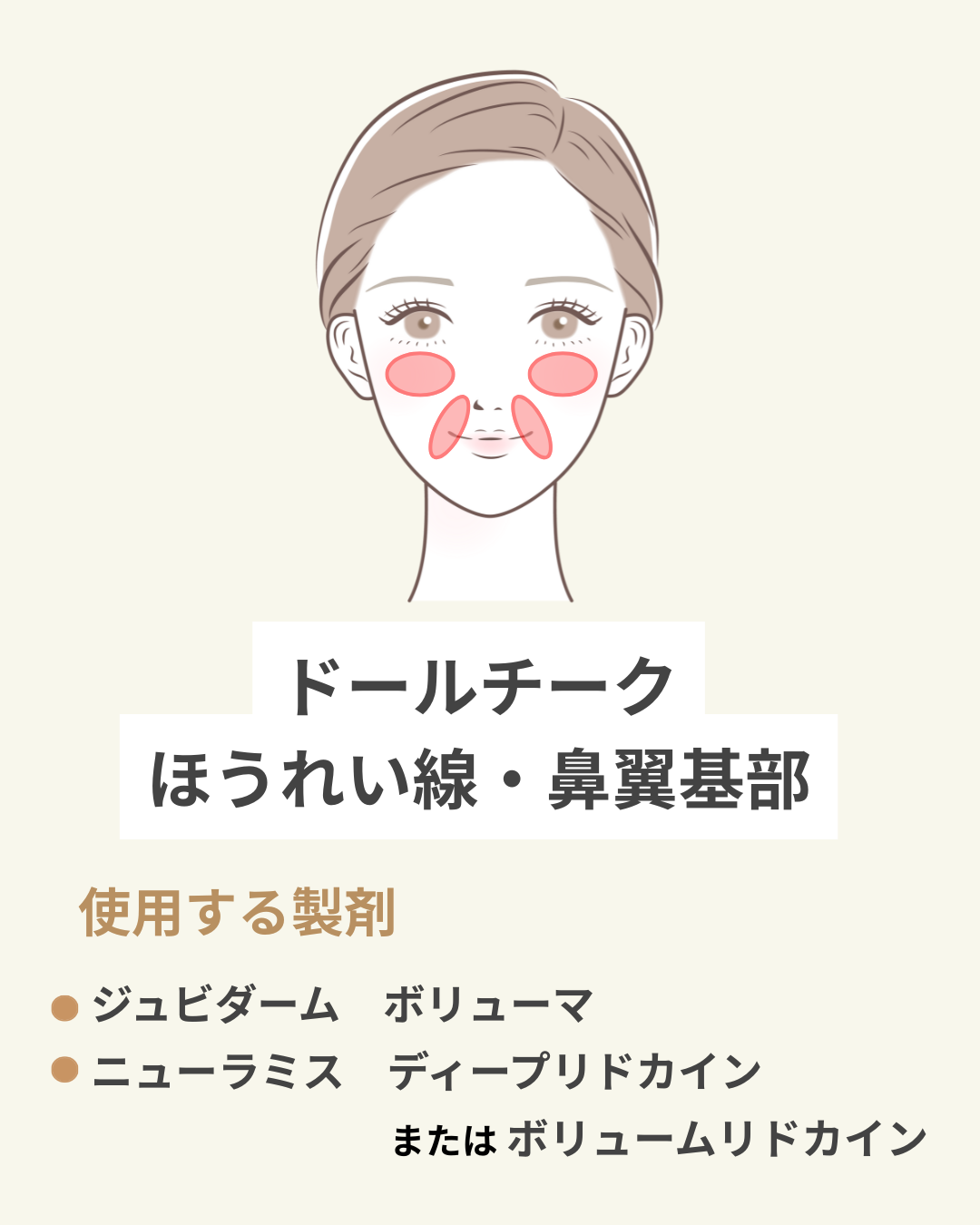 ドールチーク・ほうれい線