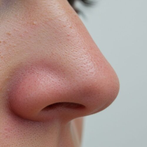 鼻整形後の腫れ期間を徹底解説！回復過程と対処法