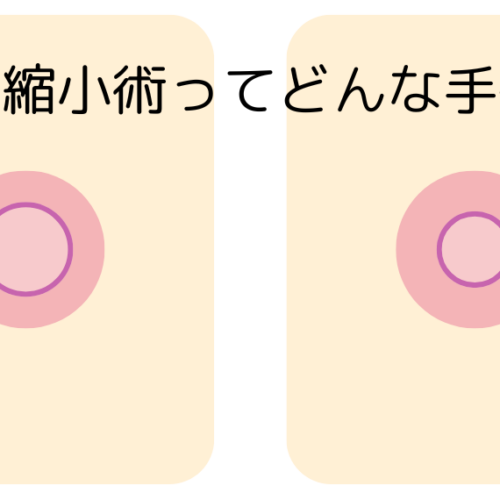 乳頭縮小術について解説します！