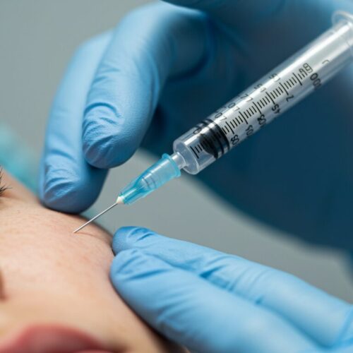 ヒアルロン酸注入の持続期間〜効果を長く保つための医師の助言