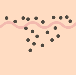 境界母斑（きょうかいぼはん）