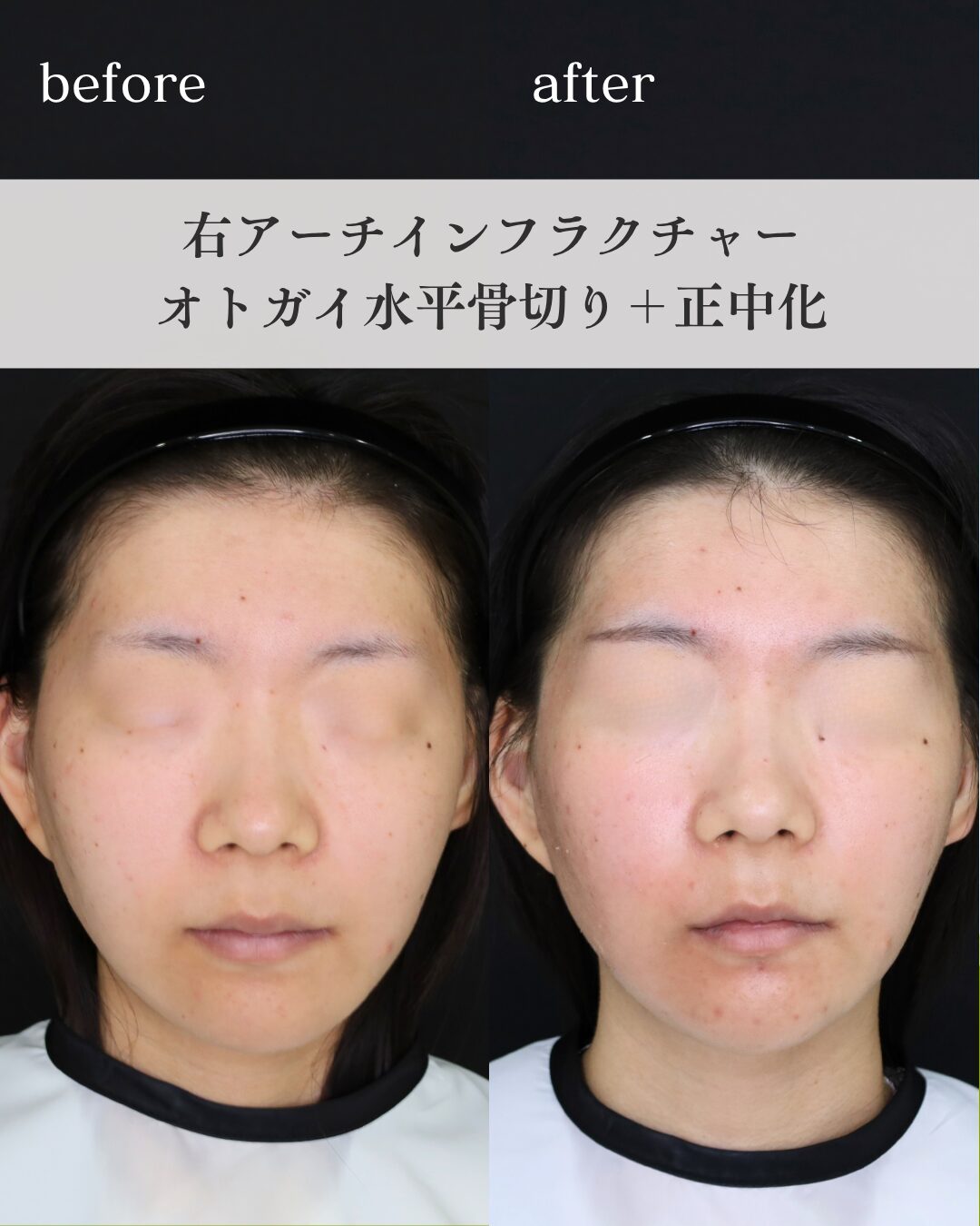 大阪・東大阪の美容外科・形成外科 KIMI CLINIC｜専門医の日帰り保険手術