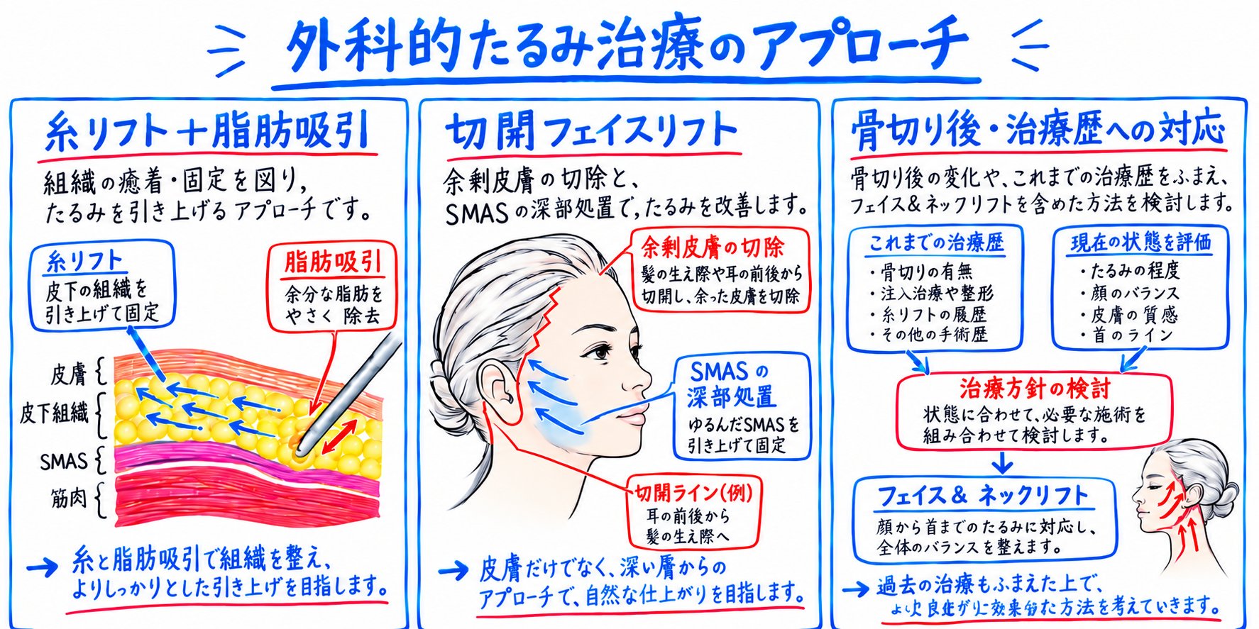 中高年のたるみ治療における4つの選択肢と外科的アプローチの利点