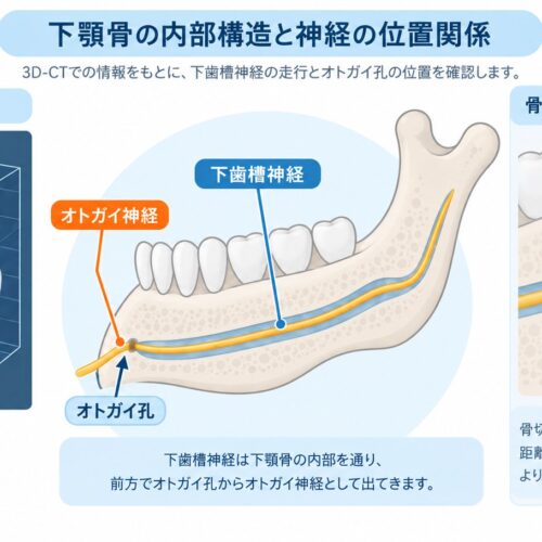 エラ骨切りでしびれが心配な方へ｜神経損傷を防ぐ術前検査とは