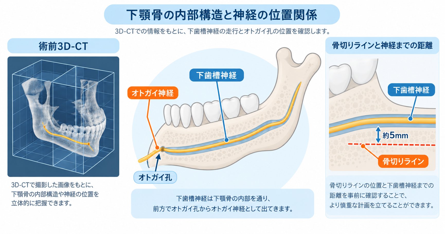 エラ骨切りでしびれが心配な方へ|神経損傷を防ぐ術前検査とは