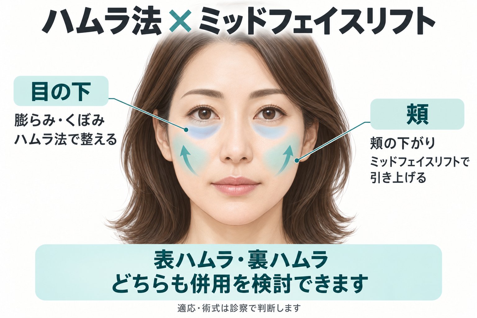 ミッドフェイスリフトは表ハムラ・裏ハムラのどちらと併用できる？切開経路と検討点
