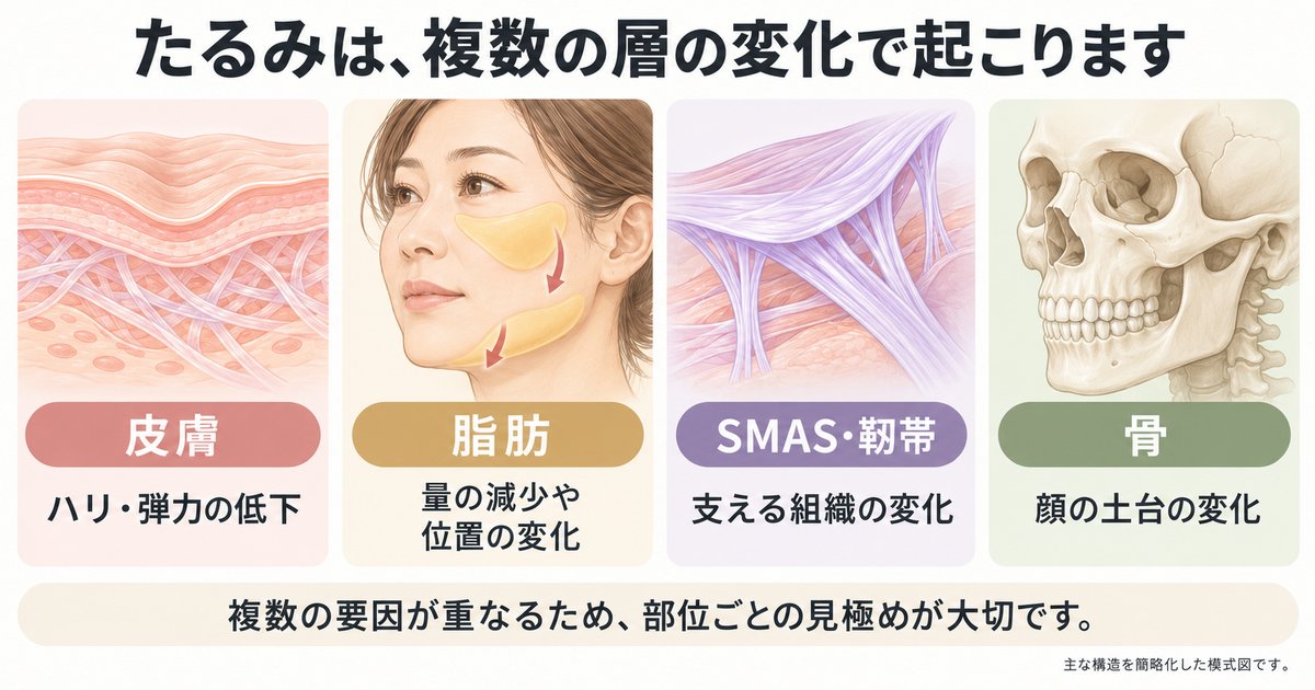 40代のたるみの原因を深さで見分ける｜皮膚・脂肪・支持組織の変化
