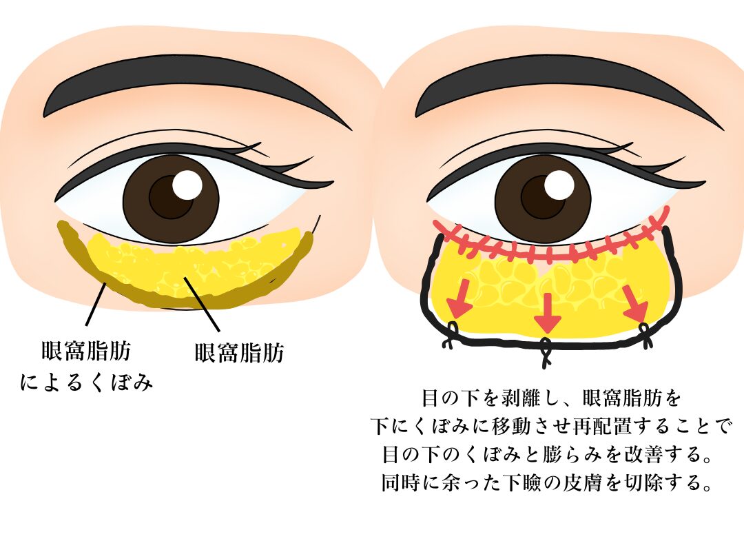 症例画像5