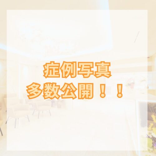 人気施術の症例を多数公開しました